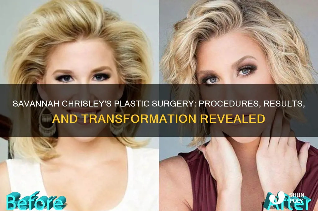 what plastic surgery has savannah chrisley had