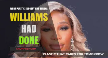 Serena Williams' Plastic Surgery: Rumors, Facts, and Transformations Revealed