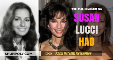 Susan Lucci's Plastic Surgery: Rumors, Facts, and Transformations Revealed