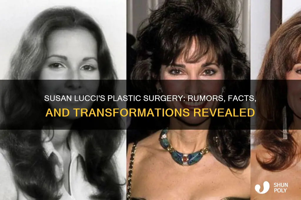 what plastic surgery has susan lucci had