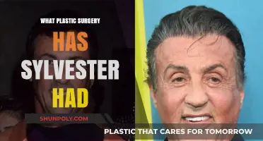 Sylvester Stallone's Plastic Surgery: Unveiling the Actor's Transformation Journey