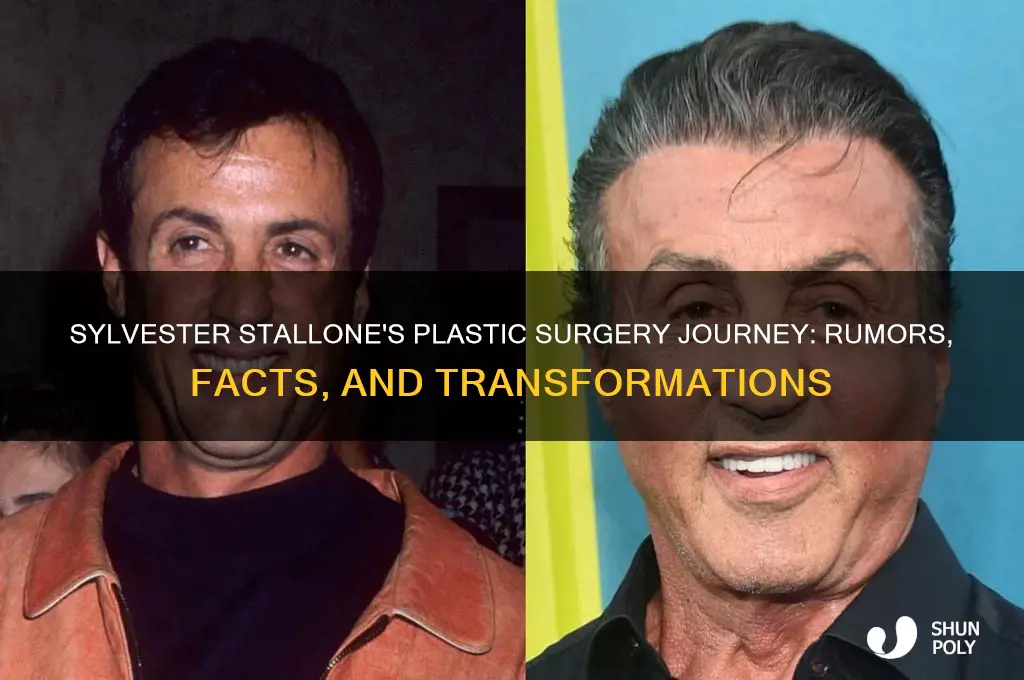 what plastic surgery has sylvester stallone had