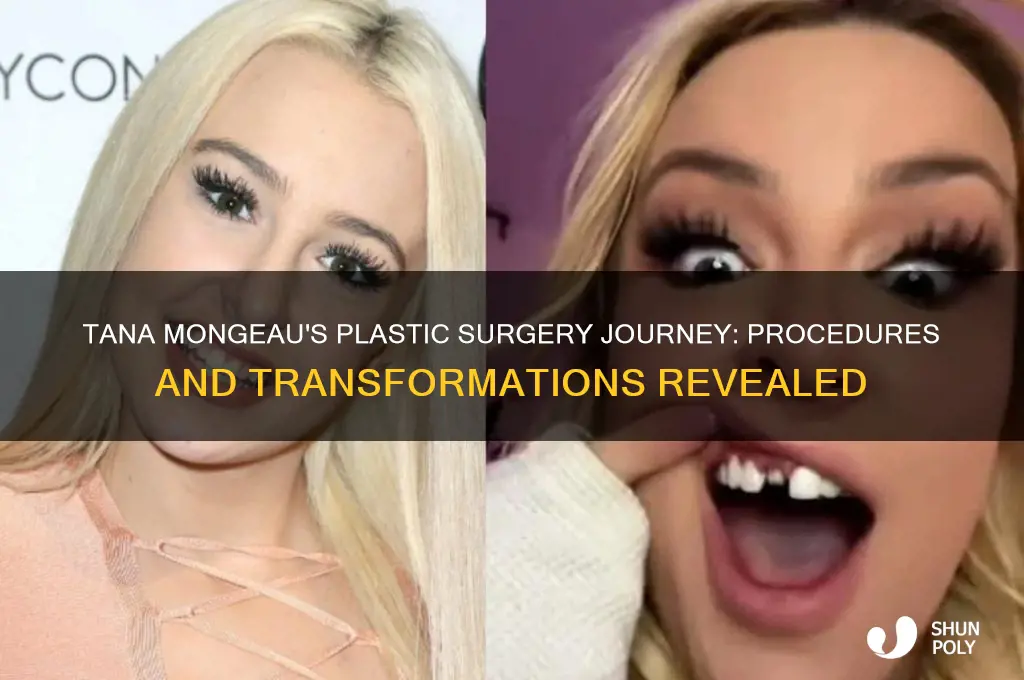 what plastic surgery has tana mongeau had