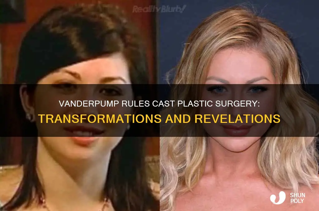 what plastic surgery has vanderpump rules cast gotten