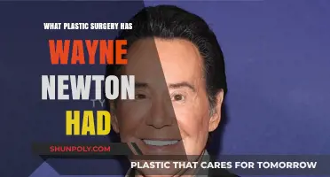 Wayne Newton's Plastic Surgery: Unveiling the Star's Transformation Journey