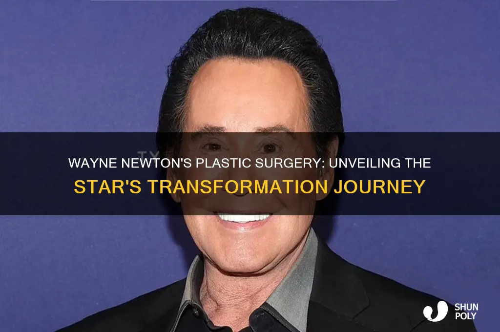 what plastic surgery has wayne newton had