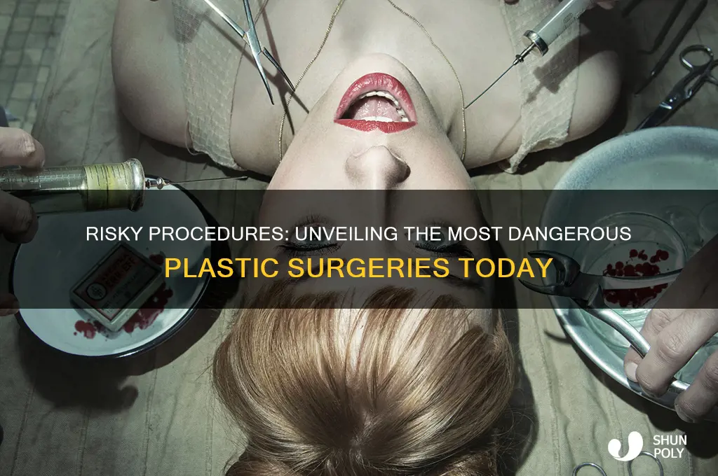 what plastic surgery is the most dangerous