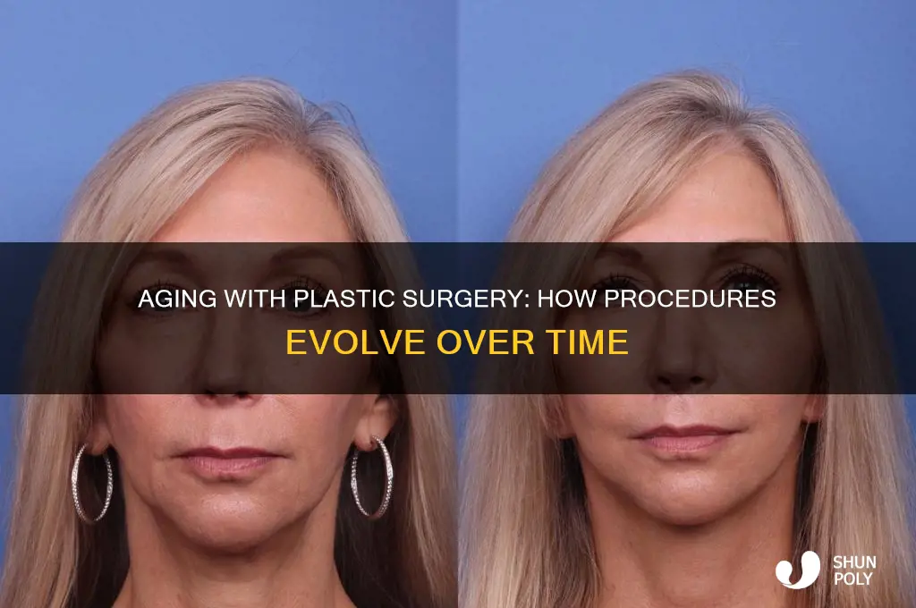 what plastic surgery looks like when you age