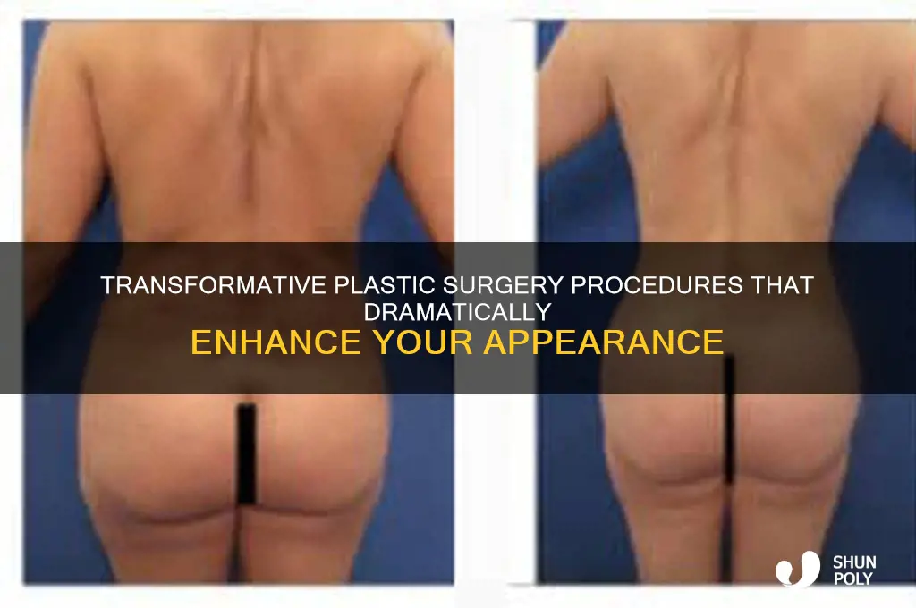 what plastic surgery makes the biggest difference