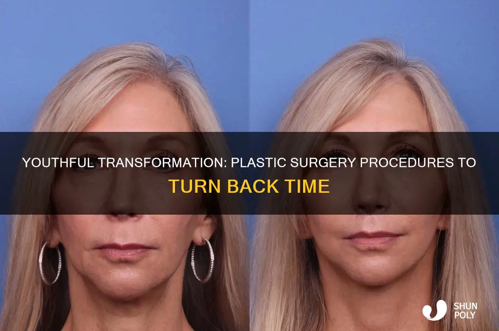 what plastic surgery makes you look younger