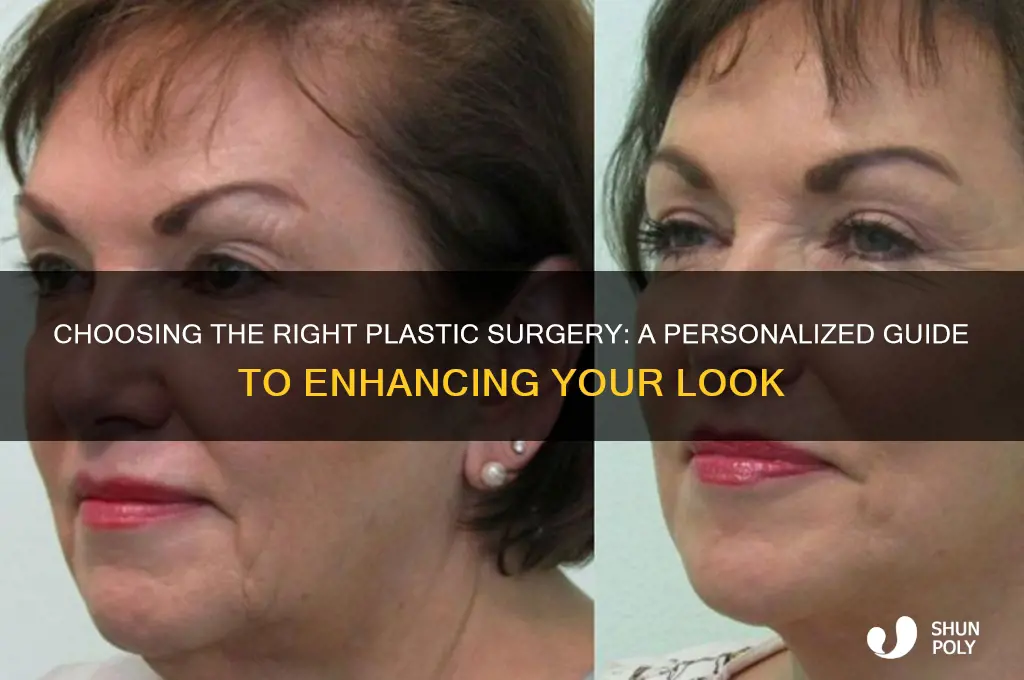 what plastic surgery should i get