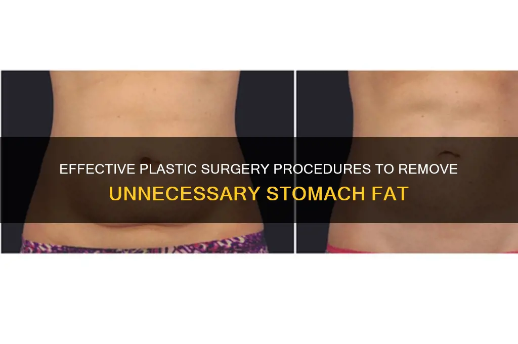 what plastic surgery takes away unnecessary stomach fat
