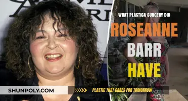Roseanne Barr's Plastic Surgery Journey: Procedures and Transformations Revealed