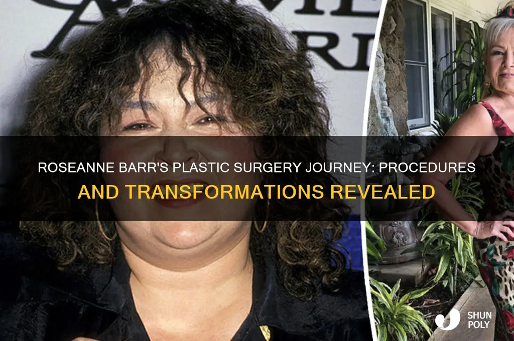 what plastica surgery did roseanne barr have