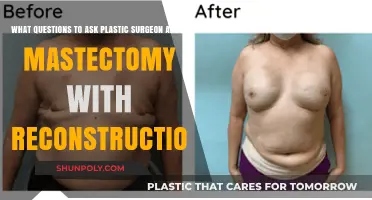 Essential Mastectomy Reconstruction Questions for Your Plastic Surgeon Consultation