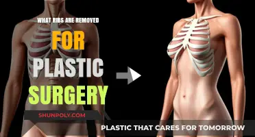 Understanding Rib Removal in Plastic Surgery: Procedure, Risks, and Recovery