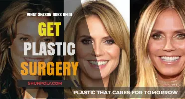 Heidi's Plastic Surgery: Unveiling the Season of Her Transformation