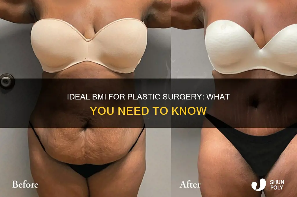 what should your bmi be for plastic surgery