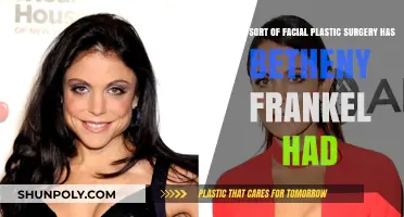 Bethenny Frankel's Facial Plastic Surgery: Rumors, Facts, and Transformations