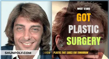 Celebrities Under the Knife: Stars Who Got Plastic Surgery