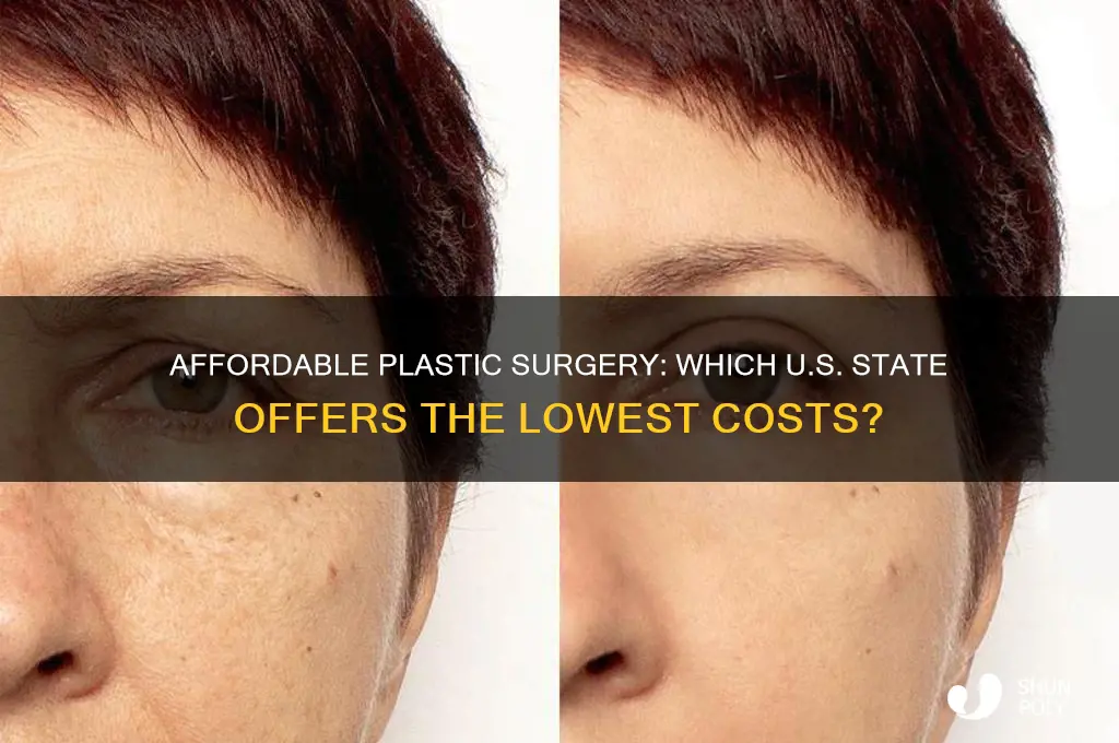 what state has cheapest plastic surgery