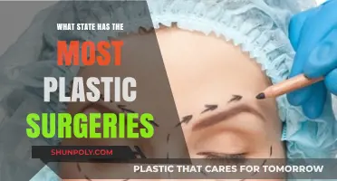 Which U.S. State Leads in Plastic Surgery Procedures?