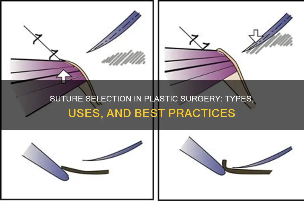 what sutures are used in plastic surgery
