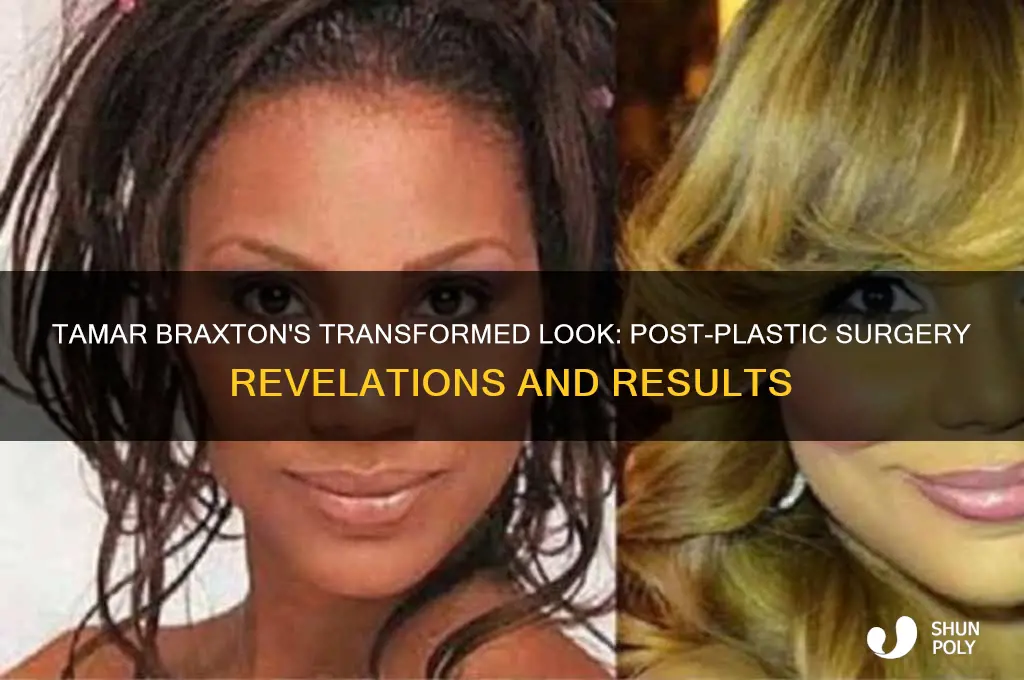 what tamar braxton look like after plastic surgery