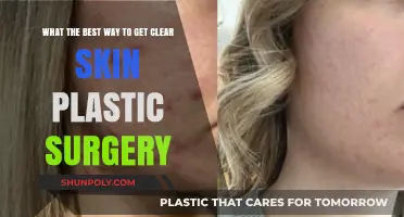 Achieve Flawless Skin: Exploring Plastic Surgery Options for Clear Complexion