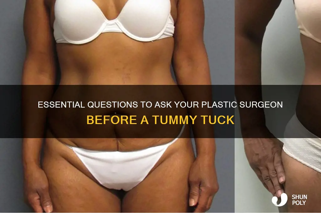 what to ask a plastic surgeon about tummy tuck