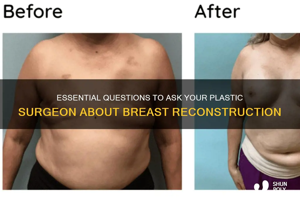 what to ask plastic surgeon about breast reconstruction