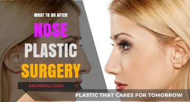 Post-Rhinoplasty Recovery: Essential Tips for Healing and Care After Surgery