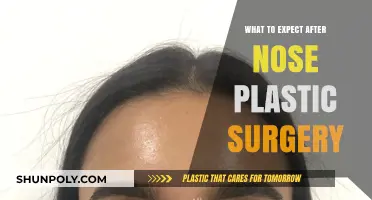 Nose Job Recovery: What to Expect After Rhinoplasty Surgery