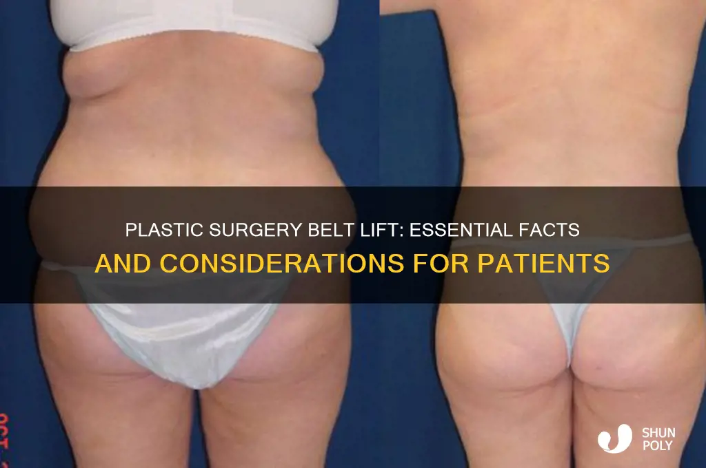what to know about plastic surgery belt lift