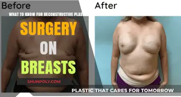 Essential Insights for Breast Reconstructive Plastic Surgery: What to Know