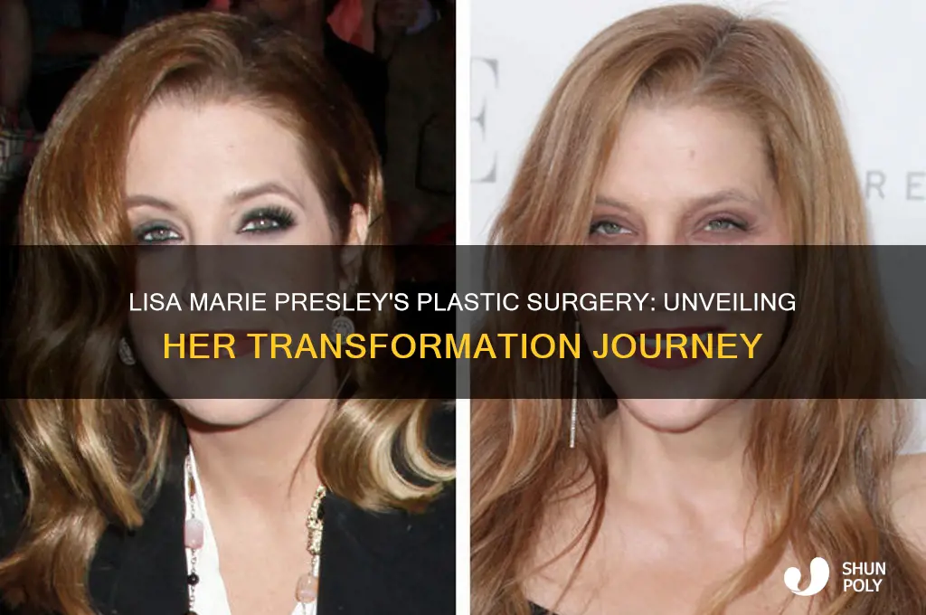 what type of plastic surgery did lisa marie presley have