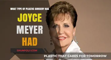 Joyce Meyer's Plastic Surgery: Unveiling Her Transformation Journey