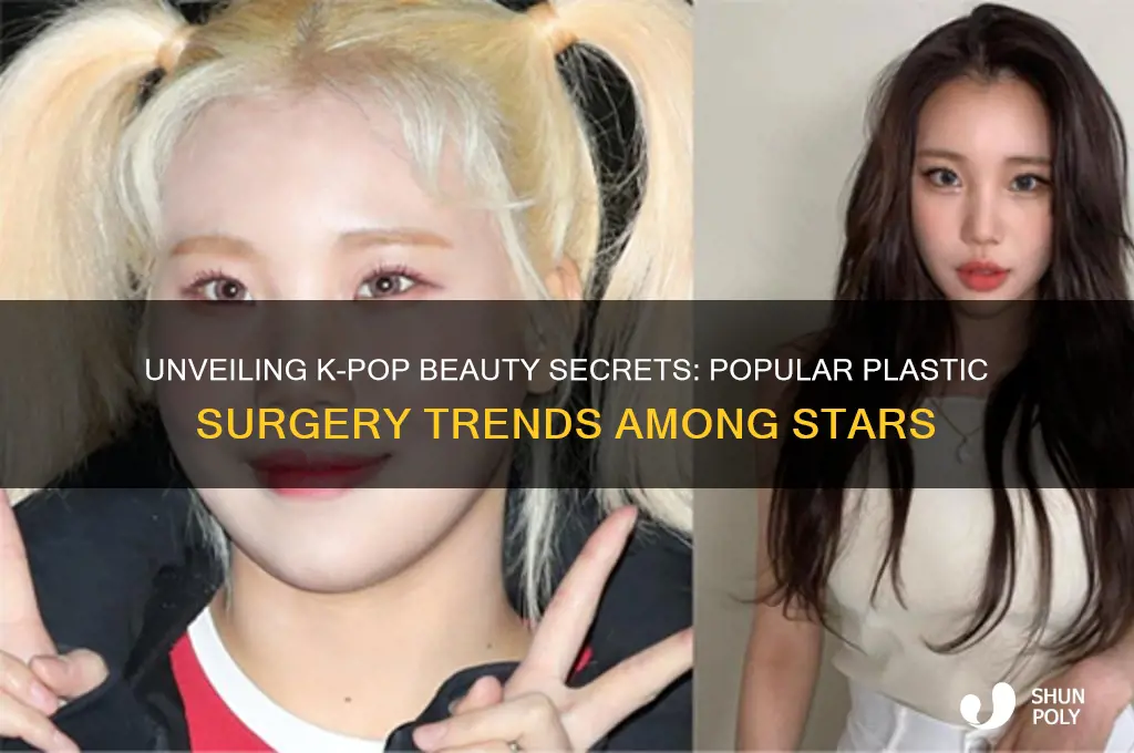 what type of plastic surgery to kpop stars get