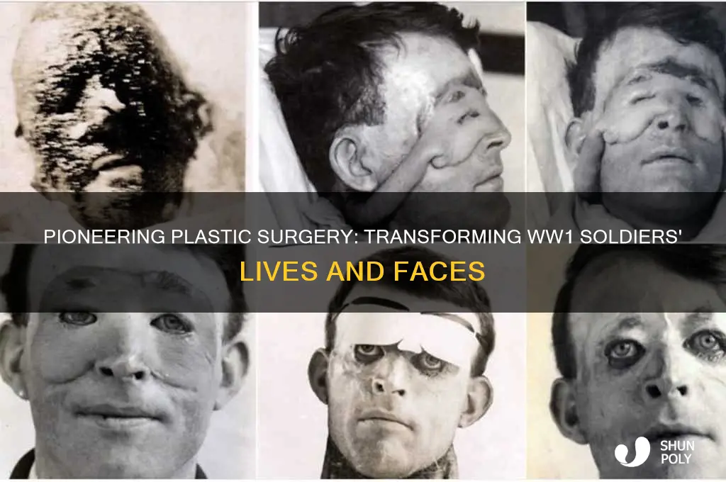 what was plastic surgery in ww1