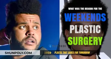 The Weeknd's Plastic Surgery: Uncovering the Motivation Behind His Transformation