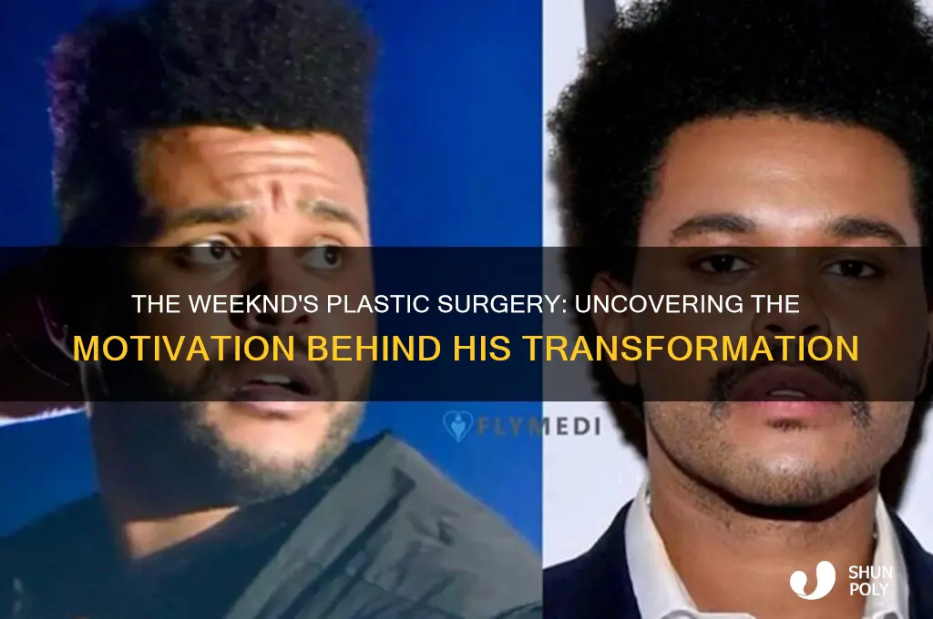 what was the reason for the weekends plastic surgery