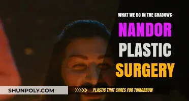 Nandor's Transformation: Unveiling the Plastic Surgery Secrets in 'What We Do in the Shadows