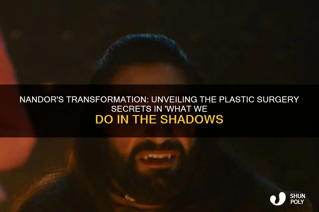 what we do in the shadows nandor plastic surgery