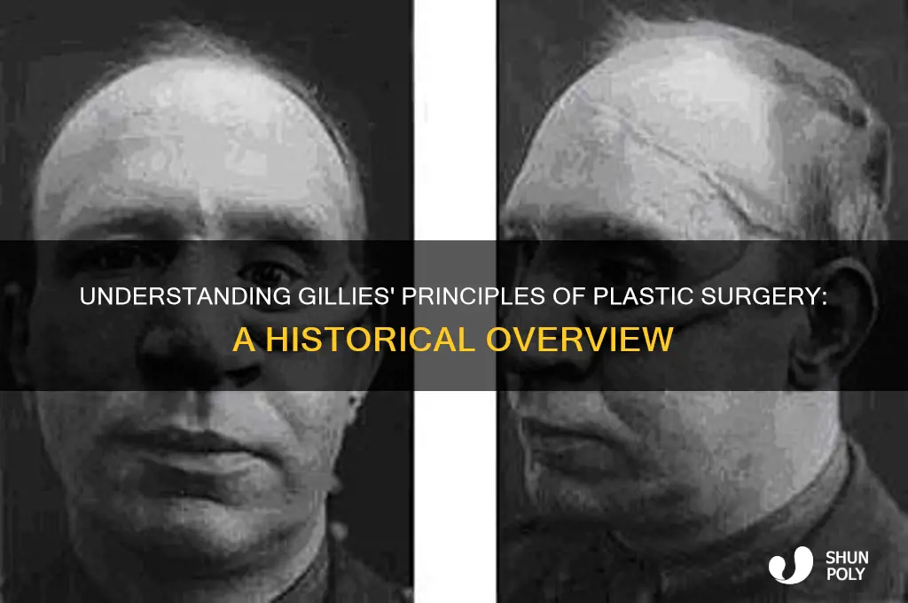 what were gillies principles of plastic surgery