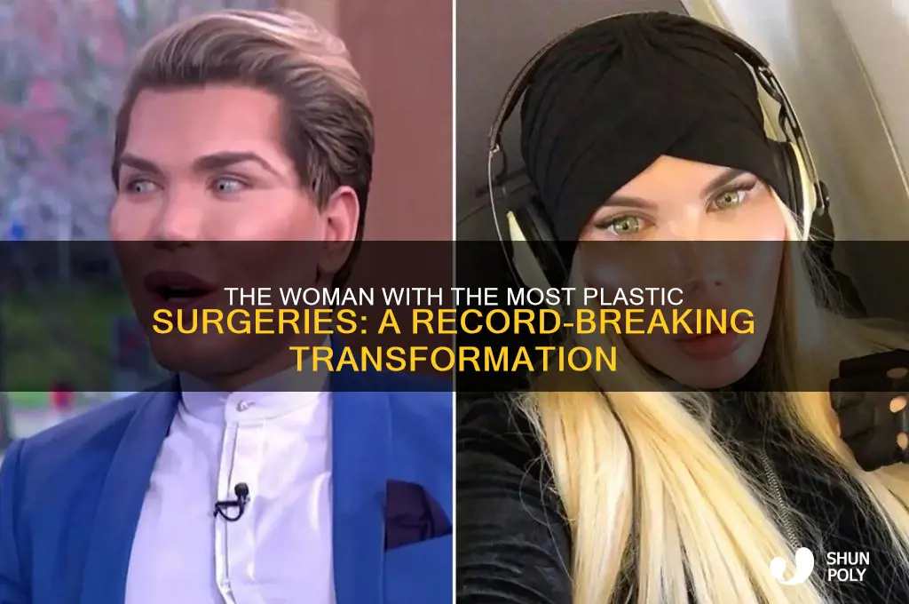 what woman has had the most plastic surgeries