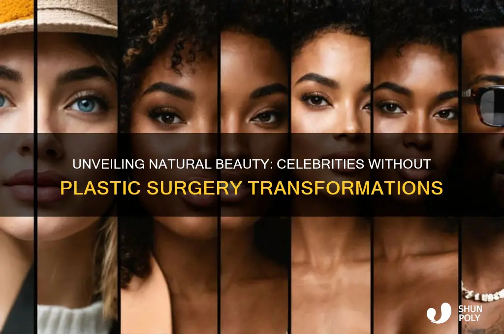what would celebrities look like without plastic surgery