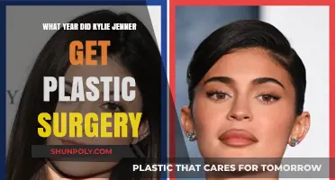 Kylie Jenner's Transformation: Unveiling Her Plastic Surgery Timeline