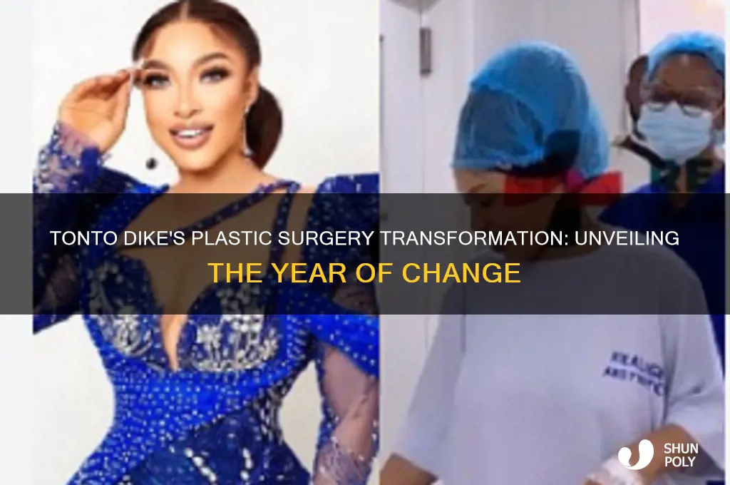 what year did tonto dike do plastic surgery