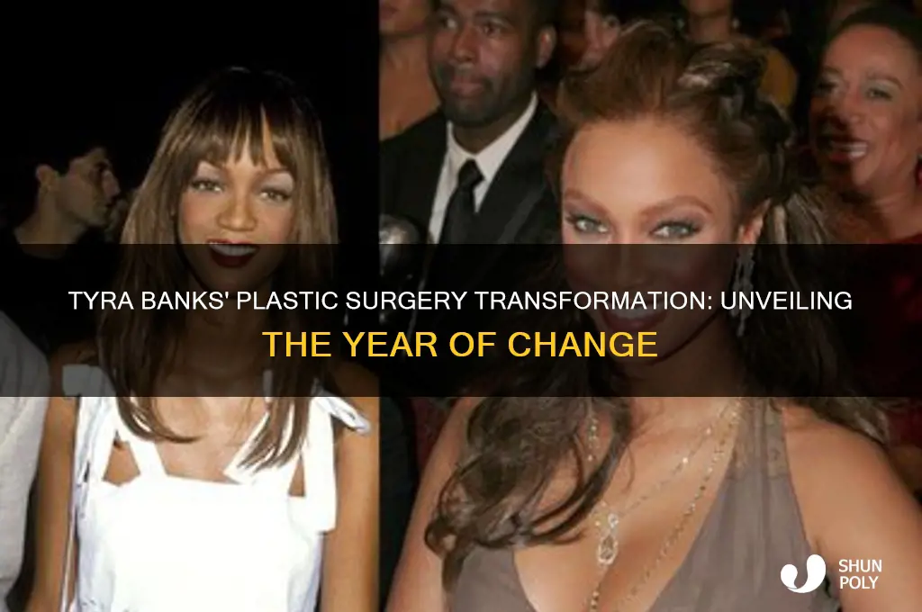 what year did tyra banks have plastic surgery