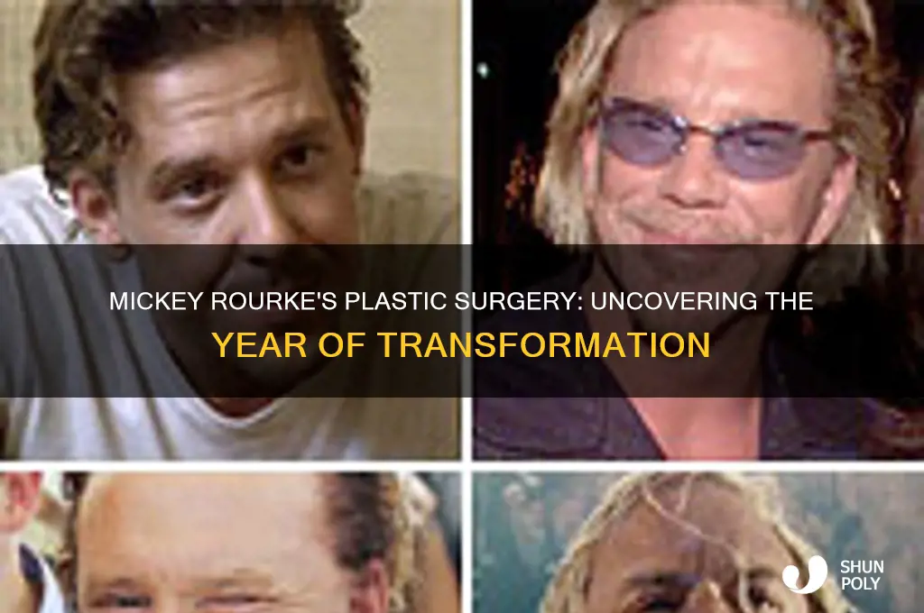 what year dif mickey rourke have plastic surgery